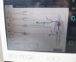 Preview: Pulsion PiCCO 2 Patientenmonitor  hämodynamisches Monitoring