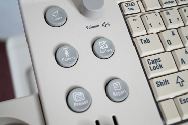 Philips HD7 BW Ultraschallgerät 2 Sonden Konvex C5-2 & Linear L12-3 + Mitsubishi CP30Dw Drucker & EKG