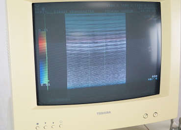 Toshiba Core Vision PRO SSA-350A Ultraschallgerät + 2 Sonden