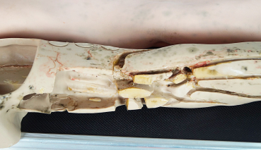 Maquet Lehrmodell Übungsarm Trainingsarm für Infusion Injektion Arm Modell
