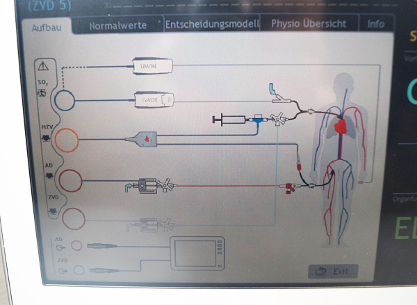 Pulsion PiCCO 2 Patientenmonitor  hämodynamisches Monitoring