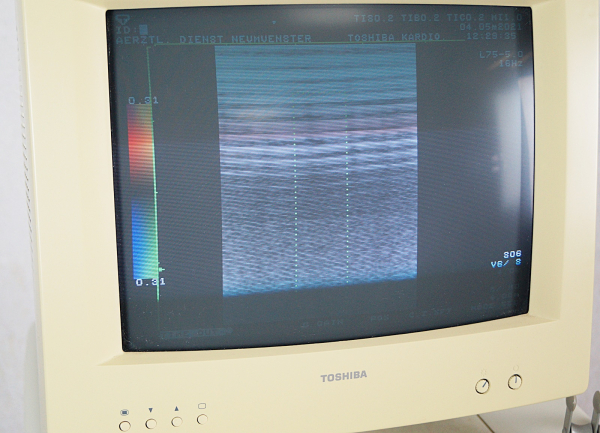 Toshiba Core Vision PRO SSA-350A Ultraschallgerät + 2 Sonden