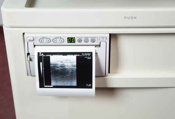 Toshiba Core Vision PRO SSA-350A Ultraschallgerät + 2 Sonden